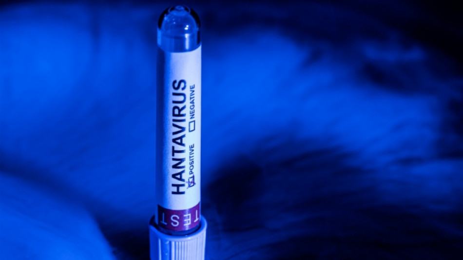 Hantavirus: pour les experts, le d&eacute;fi d'informer sans r&eacute;veiller la peur du Covid