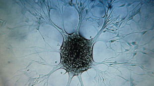 Un interruttore genetico accende i globuli bianchi contro i tumori