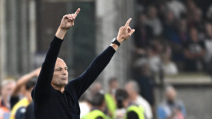Allegri 'il Frosinone sta facendo molto bene, ma il Napoli deve vincere'