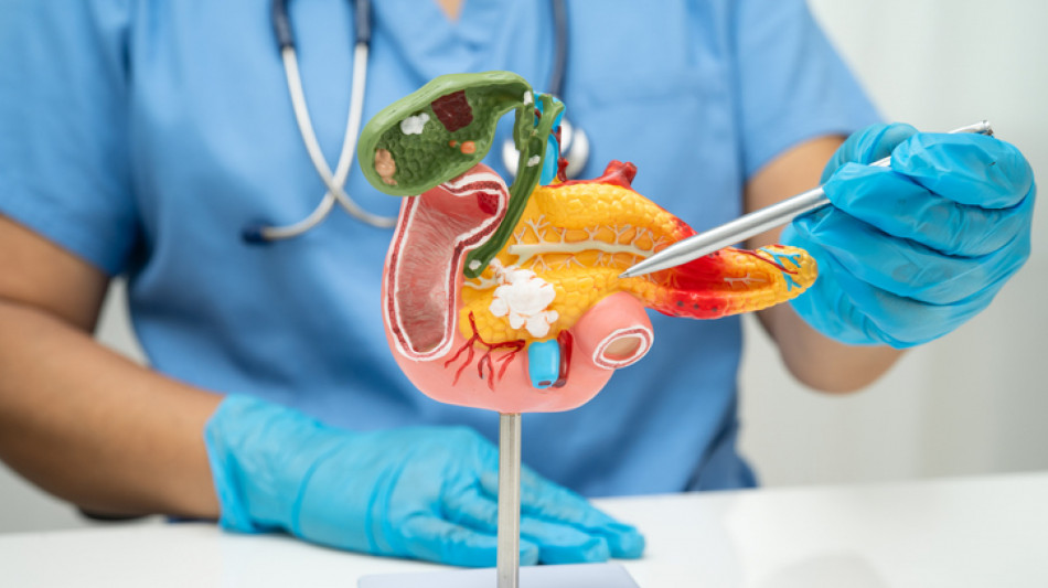 Tumore al pancreas, oltre 13mila nuove diagnosi nel 2024