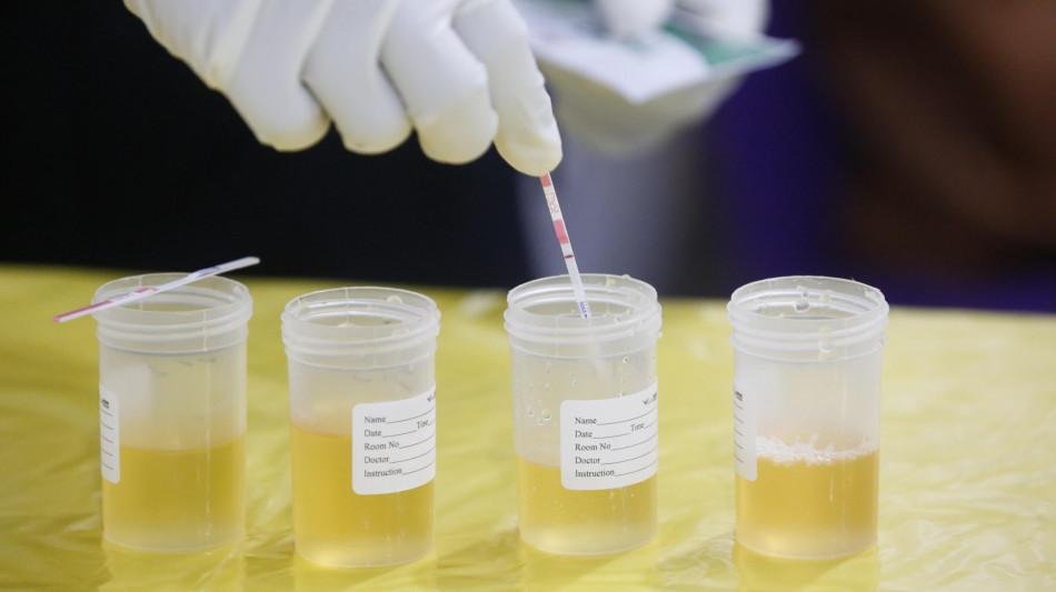 Fentanyl, possibili falsi positivi nei test rapidi in presenza di un farmaco